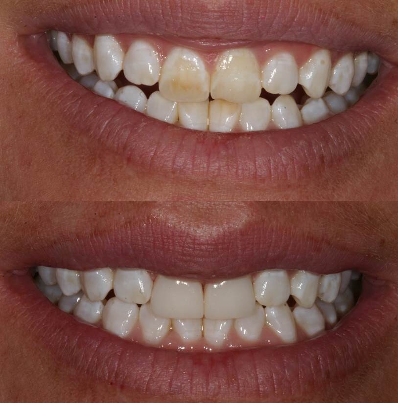 Before & After Dental works