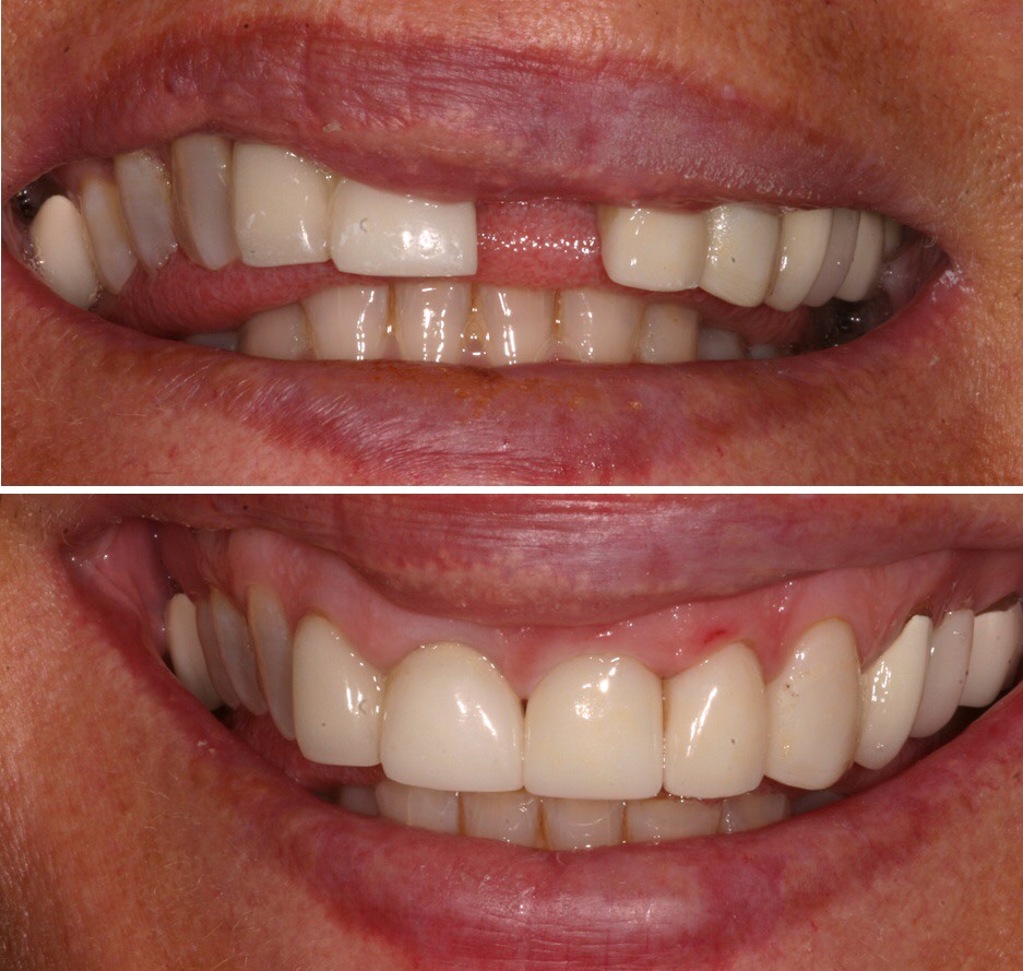 Before & After Dental works