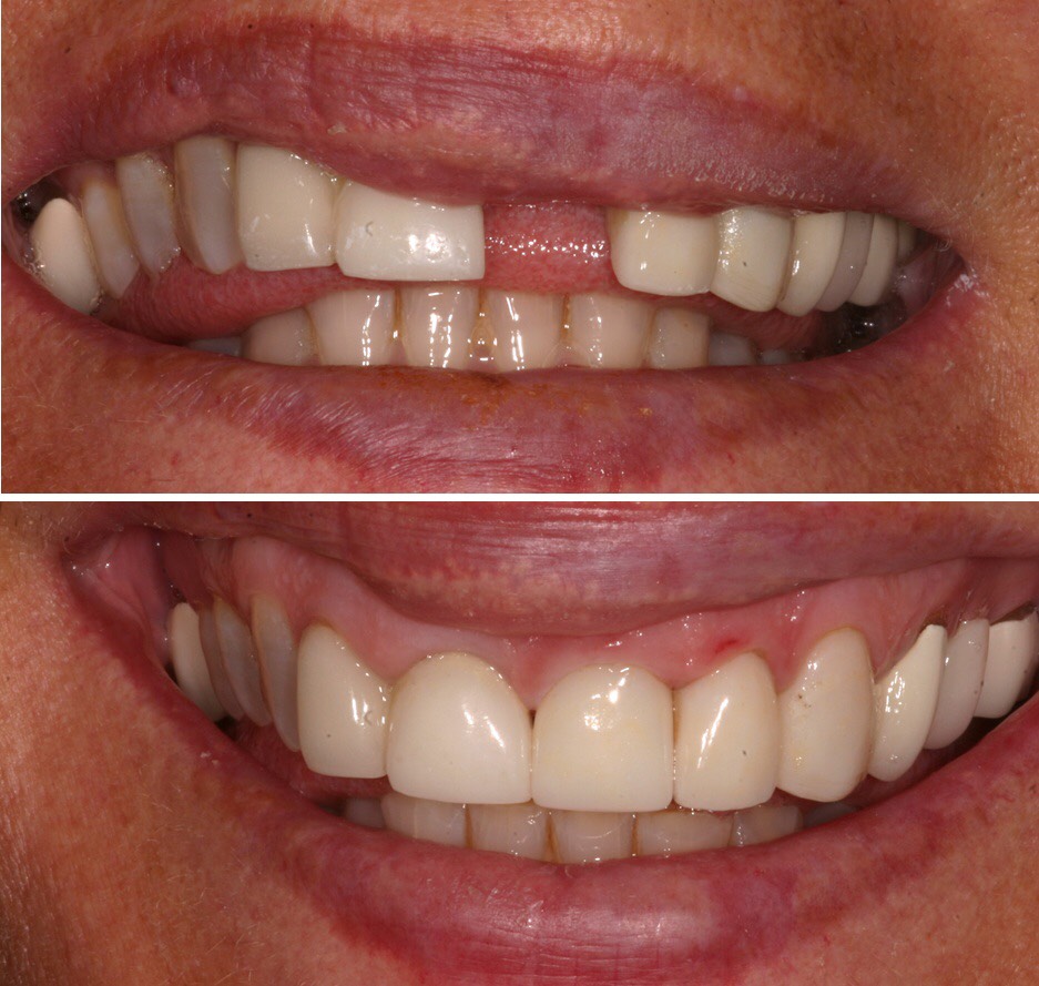 Before & After Dental works