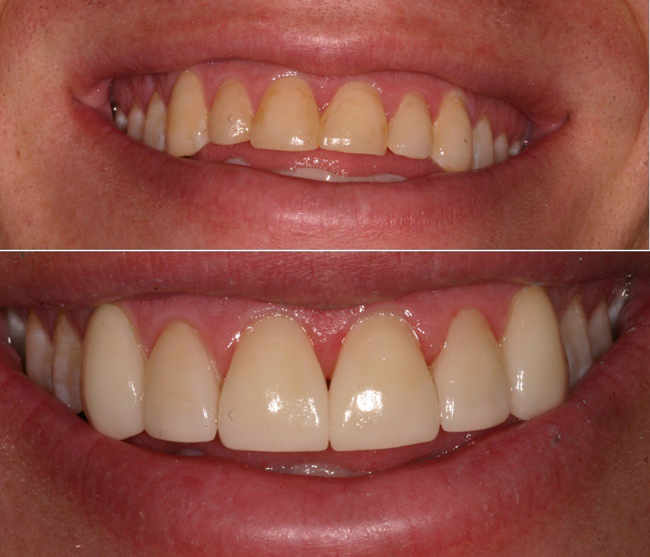 Before & After Dental works