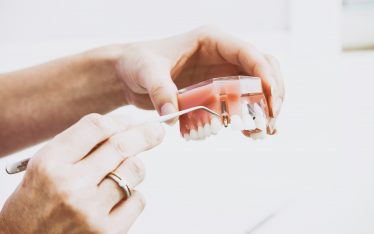 Replace Your Dental Crown, Veneer or Bridges - Colorado Springs Dentist