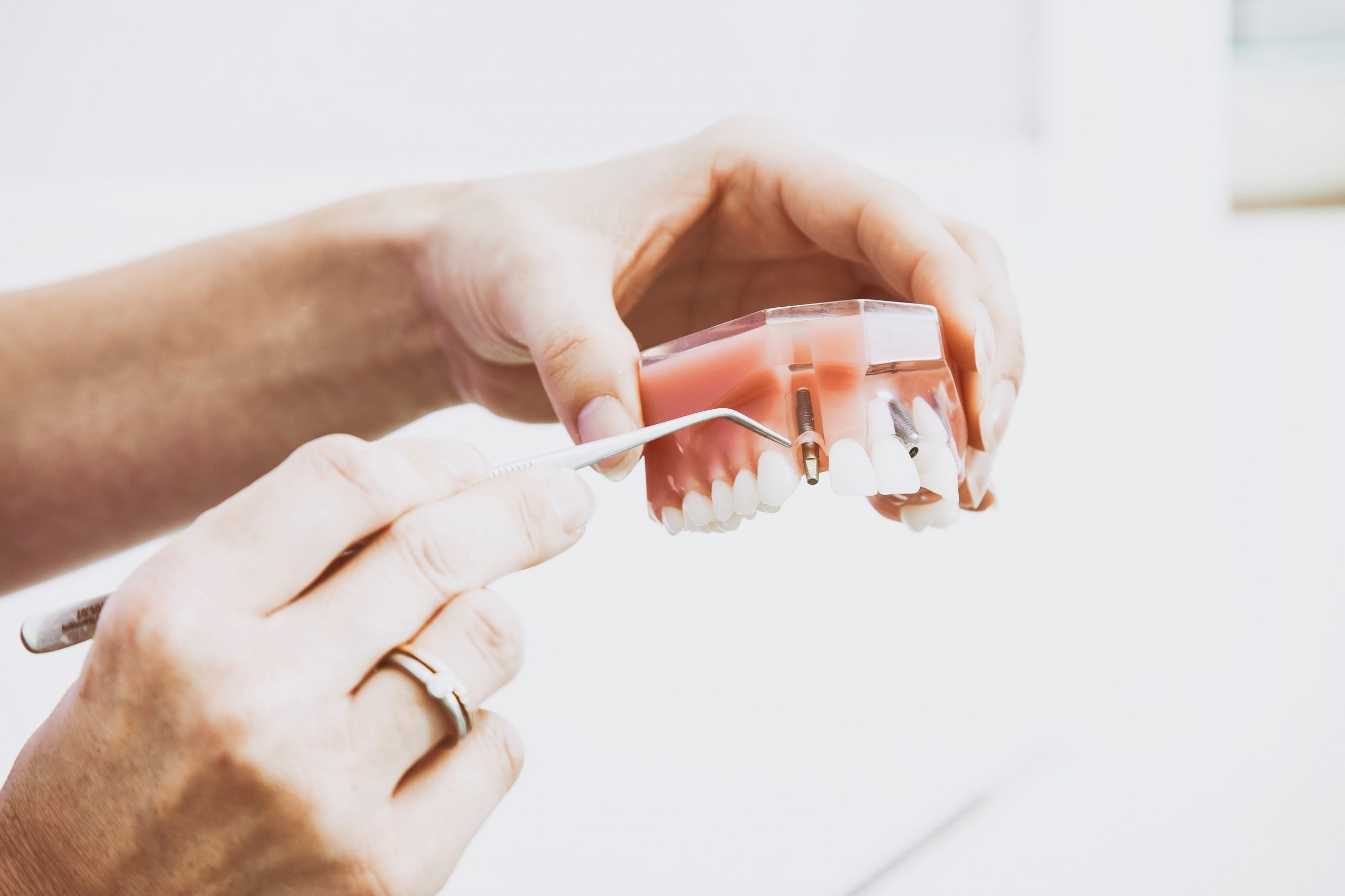 Replace Your Dental Crown, Veneer or Bridges - Colorado Springs Dentist