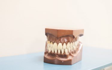 Dentures-Teeth Mold- Local Colorado Springs Dentist